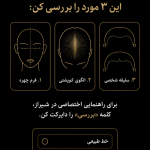 انتخاب مدل خط رویش